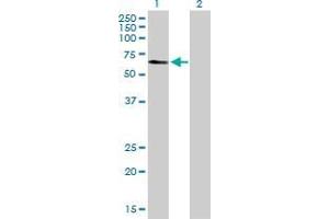 Western Blot analysis of TADA3L expression in transfected 293T cell line by TADA3L MaxPab polyclonal antibody. (TADA3L antibody  (AA 1-369))