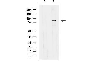 anti-TBC1 Domain Family, Member 23 (TBC1D23) (Internal Region) antibody