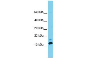 Host: Rabbit  Target Name: Med31  Sample Tissue: Rat Testis lysates  Antibody Dilution: 1.