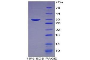 SDS-PAGE (SDS) image for Keratin 5 (KRT5) (AA 163-471) protein (His tag) (ABIN1080149)