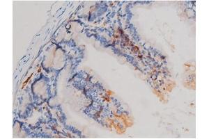 Immunohistochemistry (IHC) image for anti-Cell Division Cycle 25 Homolog A (S. Pombe) (CDC25A) (pSer75) antibody (ABIN6255495)