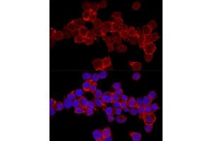 Confocal immunofluorescence analysis of THP-1 cells using CD11a/LFA-1A/ITGAL Polyclonal Antibody (ABIN3015541, ABIN3015542, ABIN3015543, ABIN1680526 and ABIN6218728) at dilution of 1:200. (ITGAL antibody  (AA 26-306))