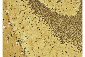 ABIN6275685 at 1/100 staining Mouse brain tissue by IHC-P.