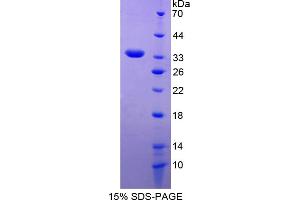 Image no. 1 for Myosin IG (MYO1G) (AA 754-1018) protein (His tag) (ABIN4989831)