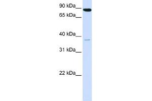 WB Suggested Anti-ACSL3 Antibody Titration:  0.