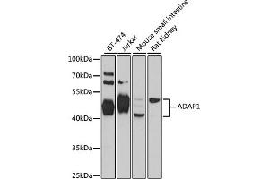 Western blot analysis of extracts of various cell lines, using  antibody  at 1:1000 dilution. (ADAP1 antibody  (AA 1-374))