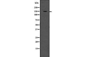 Western blot analysis of LDLR using HeLa whole  lysates. (LDLR antibody  (Internal Region))