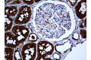 Image no. 2 for anti-Selenium Binding Protein 1 (SELENBP1) antibody (ABIN1500860) (SELENBP1 antibody)