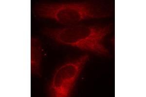 Immunofluorescence staining of methanol-fixed Hela cells using Phospho-YWHAZ-S58 antibody. (14-3-3 zeta antibody  (pSer58))