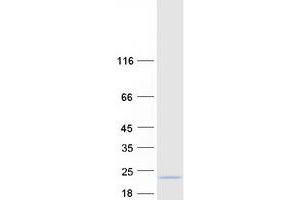 C4orf46 Protein (Myc-DYKDDDDK Tag)