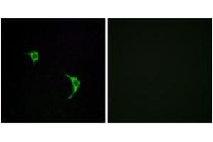Immunofluorescence analysis of LOVO cells, using SAPK/JNK (Ab-183) Antibody.