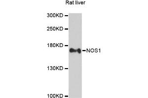 Western blot analysis of extracts of rat liver, using NOS1 antibody (ABIN1873919) at 1:2000 dilution. (NOS1 antibody)