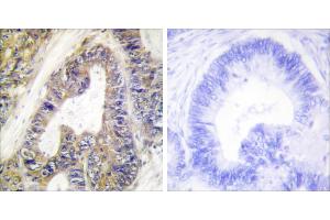 Peptide - + (EPS8-Like 1 antibody)