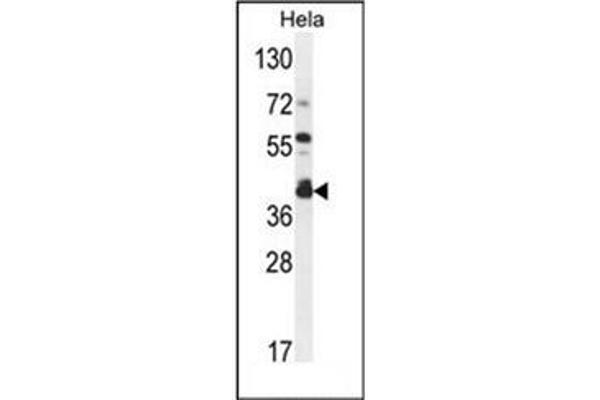 DEGS2 antibody  (C-Term)