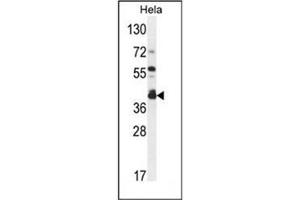Western blot analysis of DEGS2 Antibody (C-term) in Hela cell line lysates (35ug/lane). (DEGS2 antibody  (C-Term))