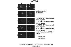 Immunohistochemistry (IHC) image for anti-Actinin, alpha 4 (ACTN4) (N-Term) antibody (ABIN2775288)