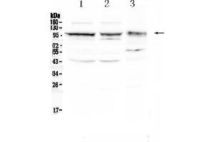 Western blot analysis of CD166/ALCAM using anti- CD166/ALCAM antibody . (CD166 antibody  (AA 167-406))