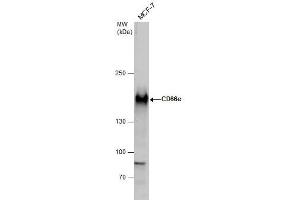 WB Image CD66e antibody detects CD66e protein by western blot analysis. (CEACAM5 antibody)