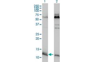 Western Blot analysis of ATPIF1 expression in transfected 293T cell line by ATPIF1 monoclonal antibody (M01), clone 3E2. (ATPase Inhibitory Factor 1 antibody  (AA 1-106))