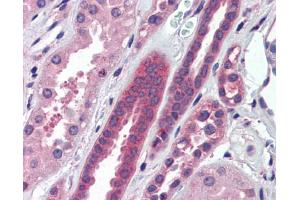 Anti-ATP6V0A2 antibody IHC staining of human kidney.
