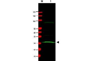 Western Blotting (WB) image for anti-MAD2 Mitotic Arrest Deficient-Like 1 (Yeast) (MAD2L1) antibody (ABIN400793) (MAD2L1 antibody)