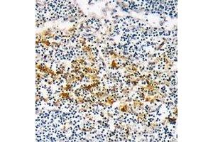 Immunohistochemical analysis of CYSLTR1 staining in human lymph node formalin fixed paraffin embedded tissue section. (CysLTR1 antibody)
