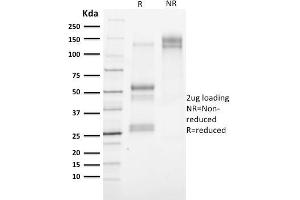 SDS-PAGE Analysis Purified Cytokeratin 3 Mouse Monoclonal Antibody (KRT3/2130). (Keratin 3 antibody)