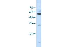 Western blot analysis of Jurkat cell lysate with KHDRBS3 polyclonal antibody .