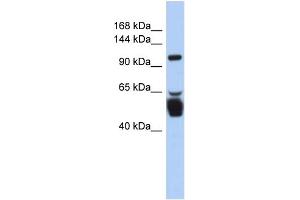 WB Suggested Anti-LRRC8B Antibody Titration:  0. (LRRC8B antibody  (N-Term))