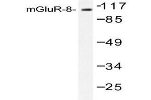 Image no. 1 for anti-Glutamate Receptor, Metabotropic 8 (GRM8) antibody (ABIN265441) (GRM8 antibody)