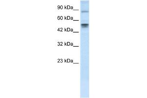WB Suggested Anti-MDM4 Antibody Titration: 0. (MDM4-binding Protein antibody  (N-Term))