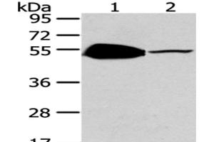 Western Blot analysis of Mouse brain and heart tissue using TSPYL1 Polyclonal Antibody at dilution of 1/200