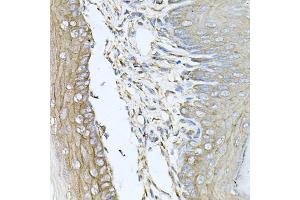 Immunohistochemistry of paraffin-embedded mouse skin using CALU antibody (ABIN5973922) at dilution of 1/100 (40x lens).