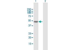 Western Blot analysis of MAGEA8 expression in transfected 293T cell line by MAGEA8 MaxPab polyclonal antibody. (MAGEA8 antibody  (AA 1-318))