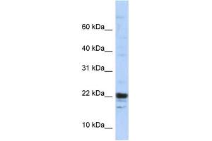 WB Suggested Anti-KIAA0040 Antibody Titration:  0. (KIAA0040 antibody  (Middle Region))