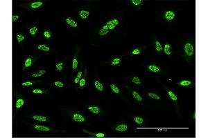 Immunofluorescence of monoclonal antibody to OXSR1 on HeLa cell. (OXSR1 antibody  (AA 351-450))