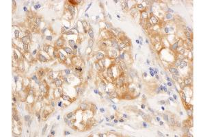 Immunohistochemistry (IHC) image for anti-Nuclear Factor-kB p65 (NFkBP65) (AA 501-551) antibody (ABIN7454789)