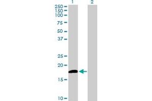 Western Blot analysis of DUSP21 expression in transfected 293T cell line by DUSP21 MaxPab polyclonal antibody. (DUSP21 antibody  (AA 1-190))