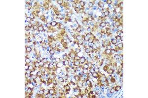 Immunohistochemistry of paraffin-embedded Rat ovary using CYB5R1 Rabbit pAb (ABIN7266630) at dilution of 1:100 (40x lens). (CYB5R1 antibody  (AA 1-305))