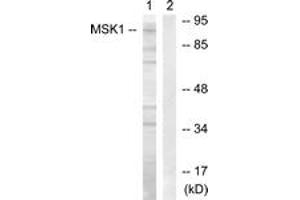 Western blot analysis of extracts from COS7 cells, treated with Sorbitol 0.