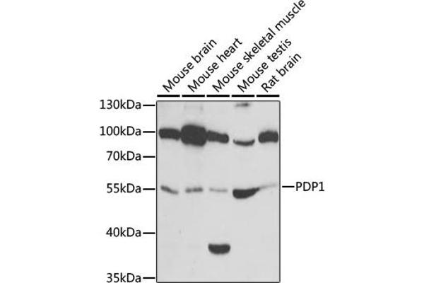 PDP antibody  (AA 278-537)