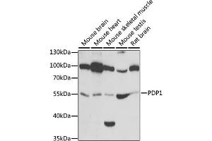 Western blot analysis of extracts of various cell lines, using PDP1 antibody (ABIN6132860, ABIN6145404, ABIN6145405 and ABIN6221944) at 1:1000 dilution. (PDP antibody  (AA 278-537))