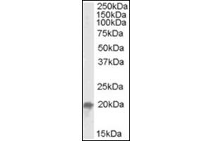 Image no. 2 for anti-Ubiquitin-Conjugating Enzyme E2F (UBE2F) (C-Term) antibody (ABIN375151)