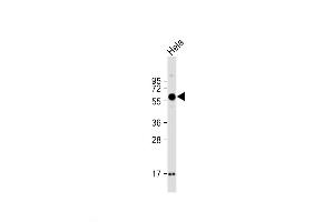 Western Blot at 1:2000 dilution + Hela whole cell lysate Lysates/proteins at 20 ug per lane. (SMOC1 antibody  (C-Term))