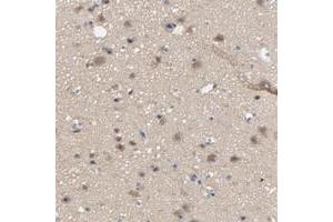 Immunohistochemical staining of human cerebral cortex with DYNLT3 polyclonal antibody  shows moderate cytoplasmic positivity in neuronal cells, glial cells. (DYNLT3 antibody)