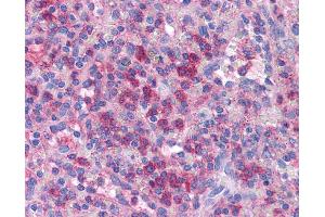 Immunohistochemistry (IHC) image for anti-PR Domain Containing 1, with ZNF Domain (PRDM1) (Middle Region) antibody (ABIN2792524) (PRDM1 antibody  (Middle Region))