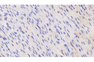 Detection of VCL in Human Cardiac Muscle Tissue using Anti-Vinculin (VCL) Polyclonal Antibody (Vinculin antibody  (AA 1020-1134))