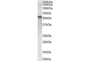 ABIN185431 (0. (VPS45 antibody  (Internal Region))
