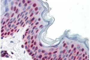 Human Skin (formalin-fixed, paraffin-embedded) stained with PAX7 antibody ABIN462176 followed by biotinylated goat anti-rabbit IgG secondary antibody ABIN481713, alkaline phosphatase-streptavidin and chromogen. (PAX7 antibody  (AA 167-216))