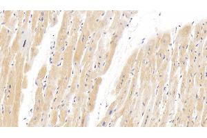 Detection of HIF2a in Human Cardiac Muscle Tissue using Polyclonal Antibody to Hypoxia Inducible Factor 2 Alpha (HIF2a) (EPAS1 antibody  (AA 26-347))